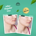 face soap for oily skin