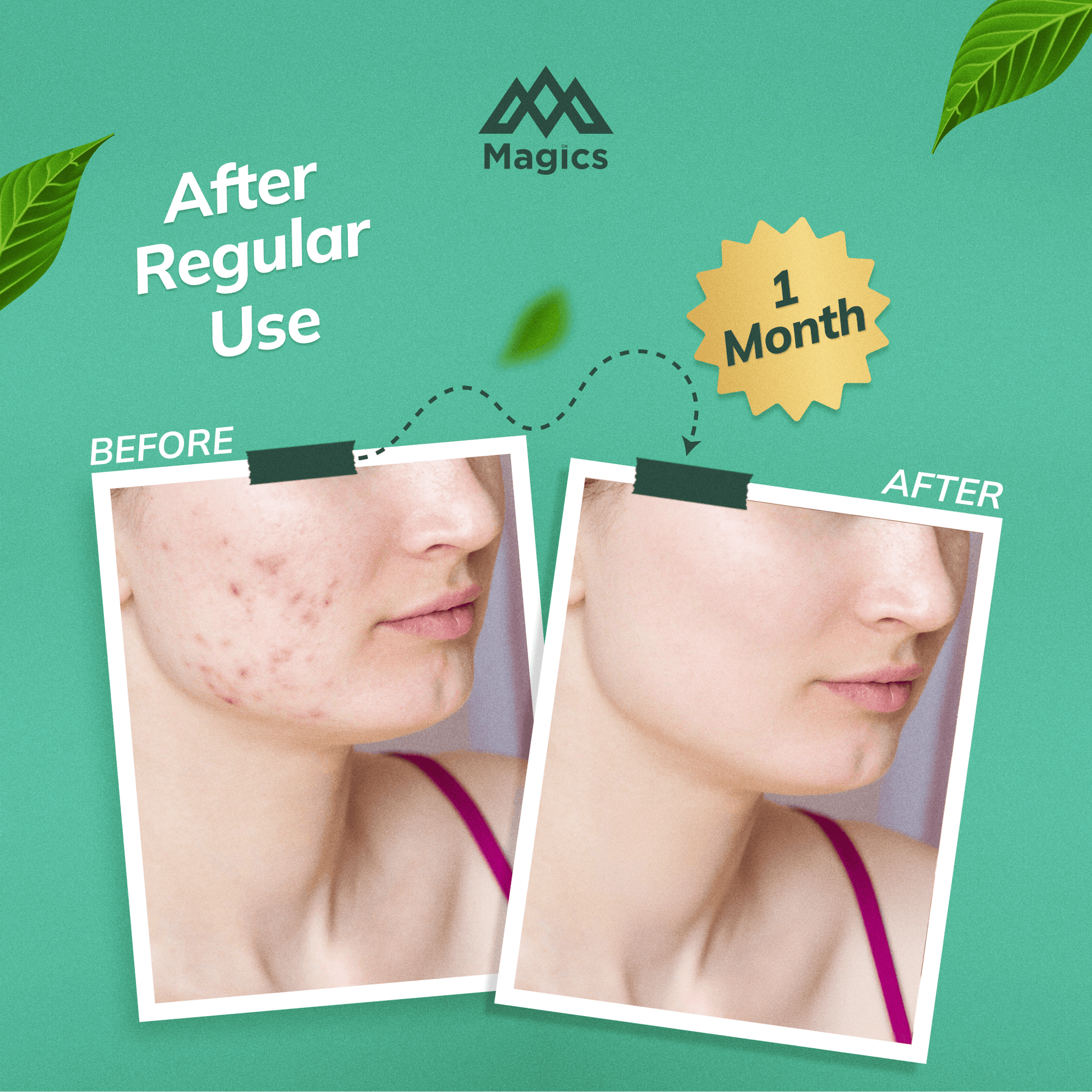 face soap for oily skin